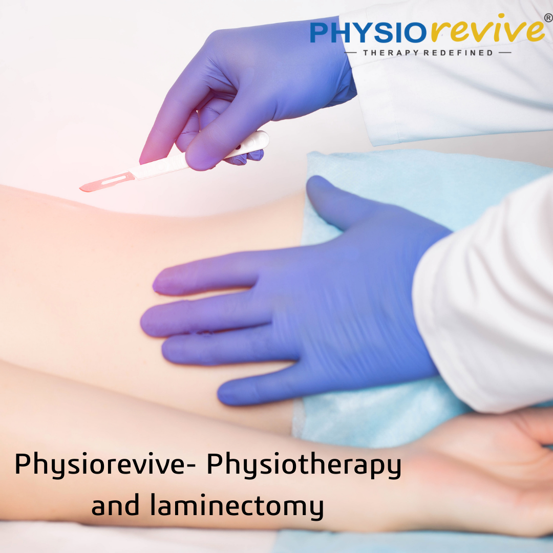 Physiorevive- Physiotherapy and laminectomy