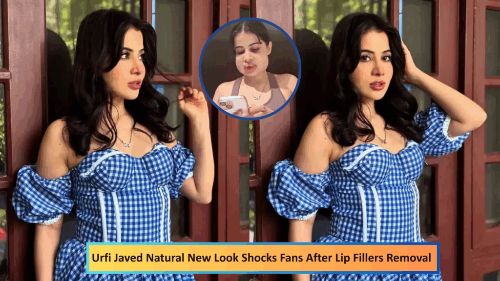 Urfi Javed Lip Filler