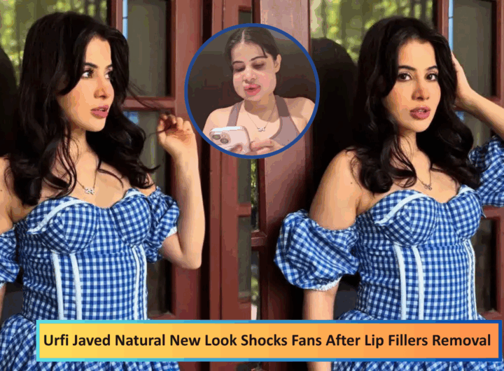 Urfi Javed Lip Filler